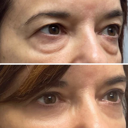 Reclaim Youthful Radiance in Just Minutes